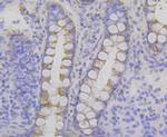 P2Y6 Antibody in Immunohistochemistry (Paraffin) (IHC (P))