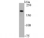 GLI3 Antibody in Western Blot (WB)