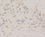 UPF1 Antibody in Immunohistochemistry (Paraffin) (IHC (P))