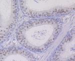 UNC84B Antibody in Immunohistochemistry (Paraffin) (IHC (P))