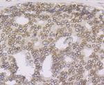 UNC84B Antibody in Immunohistochemistry (Paraffin) (IHC (P))