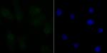 CtBP1 Antibody in Immunocytochemistry (ICC/IF)