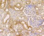 CLASP1 Antibody in Immunohistochemistry (Paraffin) (IHC (P))