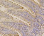 CLASP1 Antibody in Immunohistochemistry (Paraffin) (IHC (P))