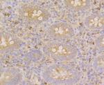 CLASP1 Antibody in Immunohistochemistry (Paraffin) (IHC (P))