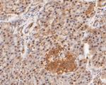 WAPL Antibody in Immunohistochemistry (Paraffin) (IHC (P))