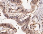 WAPL Antibody in Immunohistochemistry (Paraffin) (IHC (P))