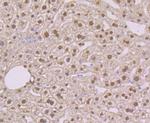 NFIB Antibody in Immunohistochemistry (Paraffin) (IHC (P))