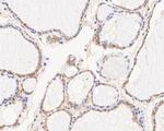 NME1 Antibody in Immunohistochemistry (Paraffin) (IHC (P))