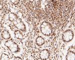 MTA2 Antibody in Immunohistochemistry (Paraffin) (IHC (P))