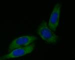 Dynamin 1 Antibody in Immunocytochemistry (ICC/IF)