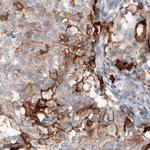 CD142 Antibody in Immunohistochemistry (Paraffin) (IHC (P))