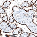 CD104 Antibody in Immunohistochemistry (Paraffin) (IHC (P))