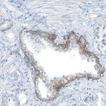 CD104 Antibody in Immunohistochemistry (Paraffin) (IHC (P))