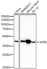 ATP Synthase beta Antibody in Western Blot (WB)