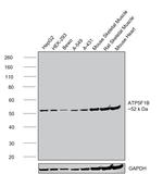 ATP Synthase beta Antibody in Western Blot (WB)