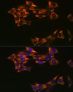 eIF4A1 Antibody in Immunocytochemistry (ICC/IF)