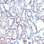 LUM Antibody in Immunohistochemistry (Paraffin) (IHC (P))