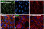 IFNGR1 Antibody