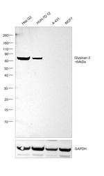 Glypican 3 Antibody