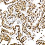 Caveolin 1 Antibody in Immunohistochemistry (Paraffin) (IHC (P))