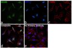 CD105 Antibody in Immunocytochemistry (ICC/IF)