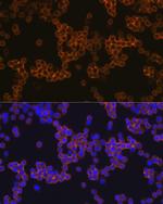 CD14 Antibody in Immunocytochemistry (ICC/IF)