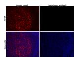 CD14 Antibody in Immunohistochemistry (Paraffin) (IHC (P))