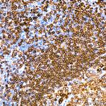 CD79a Antibody in Immunohistochemistry (Paraffin) (IHC (P))