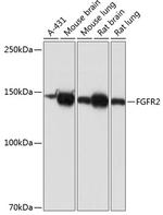 FGFR2 Antibody in Western Blot (WB)