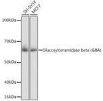 GBA Antibody in Western Blot (WB)