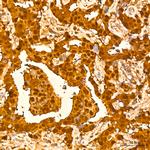 GSTP1 Antibody in Immunohistochemistry (Paraffin) (IHC (P))