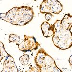 GSTP1 Antibody in Immunohistochemistry (Paraffin) (IHC (P))