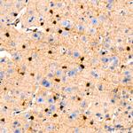 GSTP1 Antibody in Immunohistochemistry (Paraffin) (IHC (P))