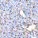 GSTP1 Antibody in Immunohistochemistry (Paraffin) (IHC (P))