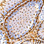 GSTP1 Antibody in Immunohistochemistry (Paraffin) (IHC (P))