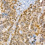 YAP1 Antibody in Immunohistochemistry (Paraffin) (IHC (P))