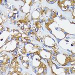 RARA Antibody in Immunohistochemistry (Paraffin) (IHC (P))