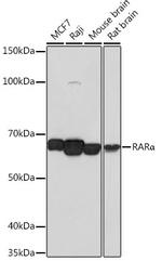 RARA Antibody in Western Blot (WB)