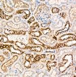 Cathepsin D Antibody in Immunohistochemistry (Paraffin) (IHC (P))