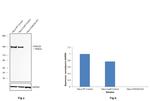 FANCD2 Antibody in Western Blot (WB)