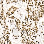 SRSF1 Antibody in Immunohistochemistry (Paraffin) (IHC (P))