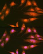 PP1 beta Antibody in Immunocytochemistry (ICC/IF)