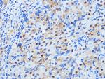 PP1 beta Antibody in Immunohistochemistry (Paraffin) (IHC (P))