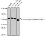 WARS Antibody in Western Blot (WB)