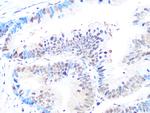 CK2 beta Antibody in Immunohistochemistry (Paraffin) (IHC (P))