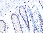 MTA2 Antibody in Immunohistochemistry (Paraffin) (IHC (P))