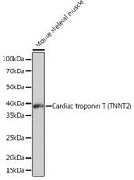 Cardiac Troponin T Antibody in Western Blot (WB)