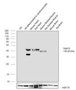 Cardiac Troponin T Antibody in Western Blot (WB)