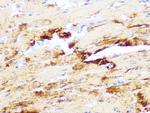 Myosin Heavy Chain Antibody in Immunohistochemistry (Paraffin) (IHC (P))